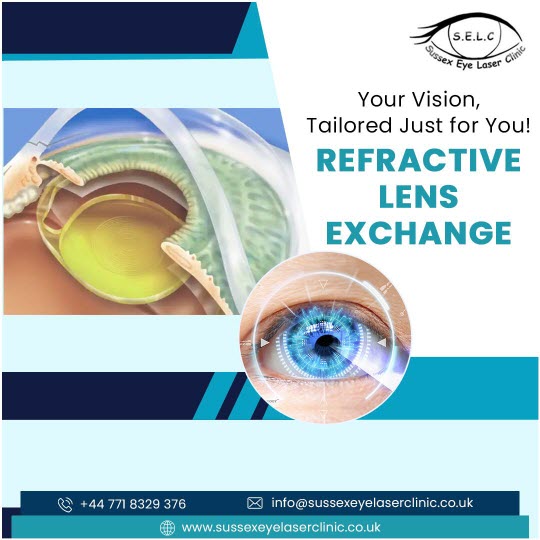 Refractive Lens Exchange Surgery
