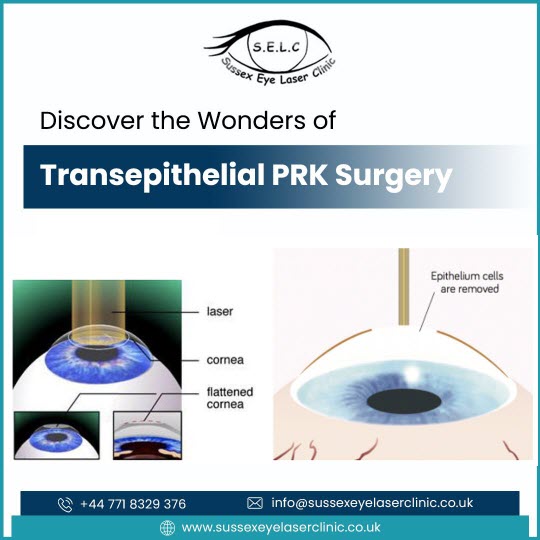 Transepithelial PRK Surgery
