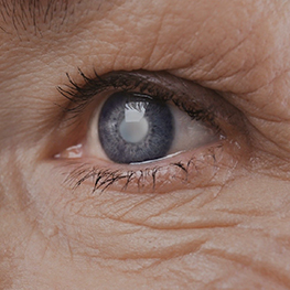 Cataract Surgery - Getting Rid Of The Mist From The Cataract