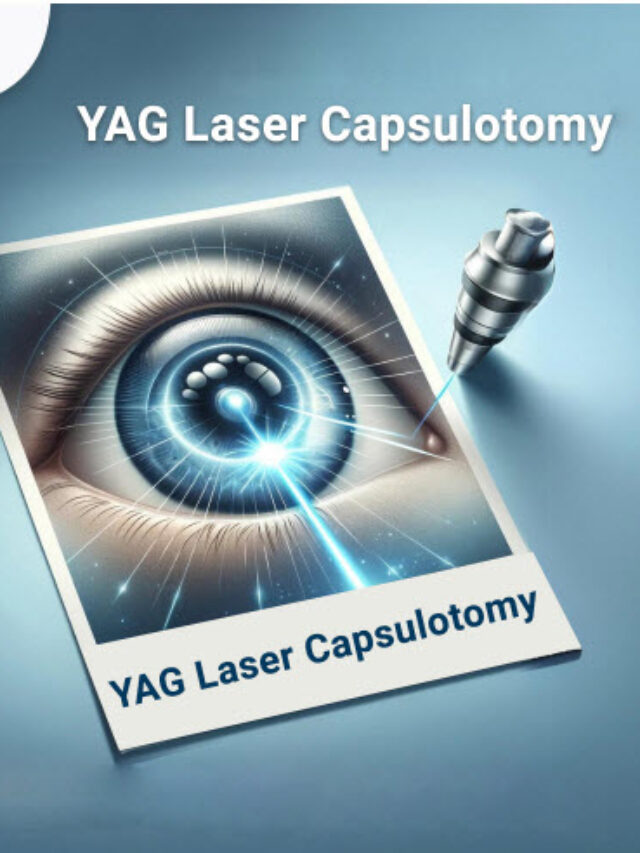 YAG Laser Capsulotomy